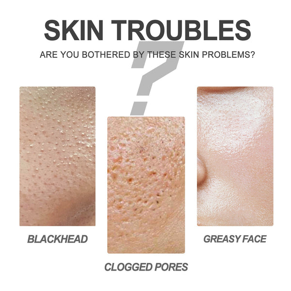 Deep Pore Blackhead Cleanser